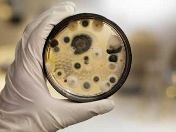 Бактерии в моче у беременных