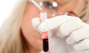 Мочевина в крови повышена: причины и как лечить пациента при данном нарушении?