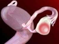 Опасность для беременности при лютеиновой и параовариальной кисте