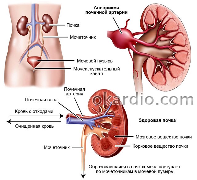 Почечное давление: причины, симптомы и лечение, как лечить артериальную гипертензию