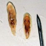 Черви и паразиты в печени человека (глисты и гельминты)