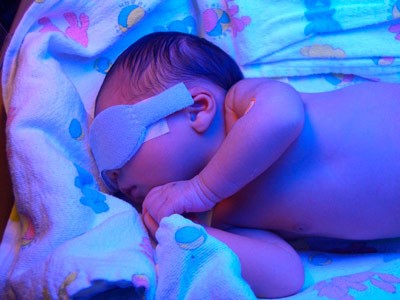 Применение Галстены при разных формах желтухи у новорожденных