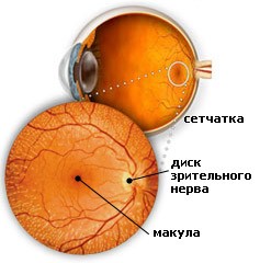 Ухудшение зрения при диабете: линзы и лазерная коррекция, лечение диабетиков