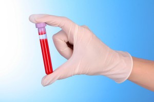 Что показывает уровень гликозилированного гемоглобина?