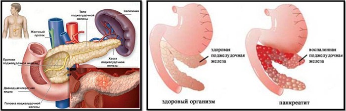Особенности народного лечения панкреатита прополисом