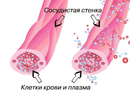 Пятна на ногах при сахарном диабете (красные, коричневые, темные)