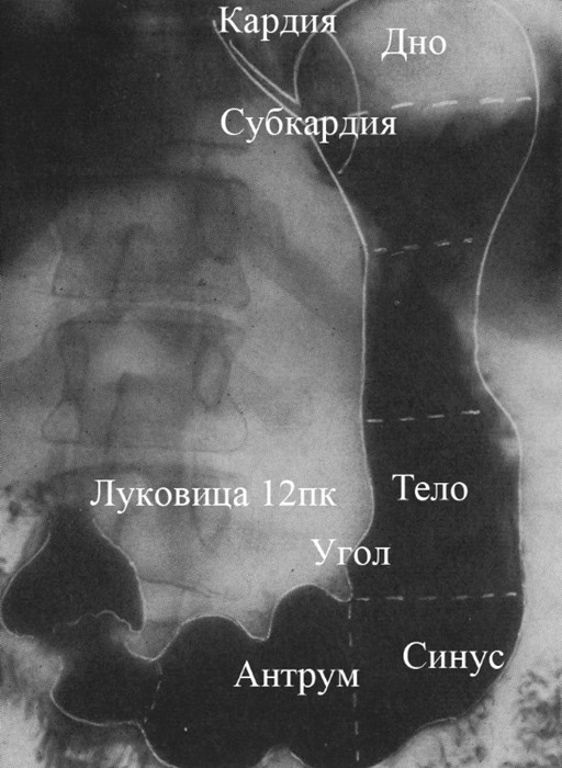 Рентгенография желудка с барием