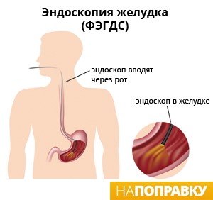 Кровяные язвы в желудке