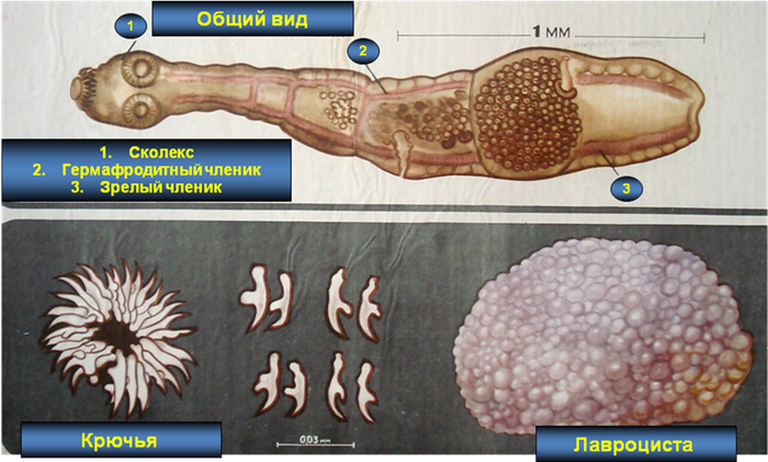 Глисты(гельминты) в тонком кишечнике человека