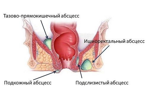 Диагностическая процедура колоноскопии кишечника