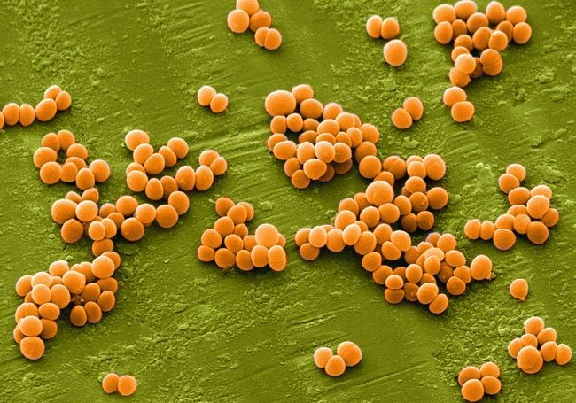 Бактерия золотистого стафилококка в кале у грудничка