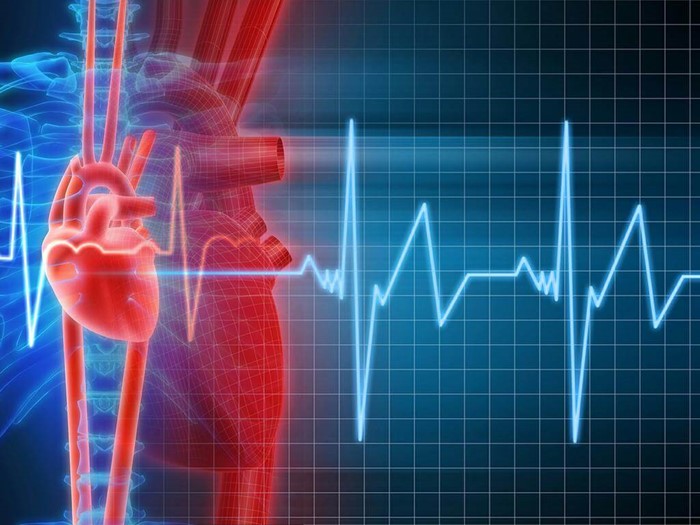 Что такое аритмия сердца?