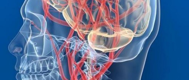 Брахиоцефальные артерии, сосуды (БЦА): анатомия, УЗДГ и другие способы диагностики патологии