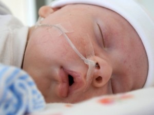 Состояние церебральной ишемии, фиксируемое у новорожденных