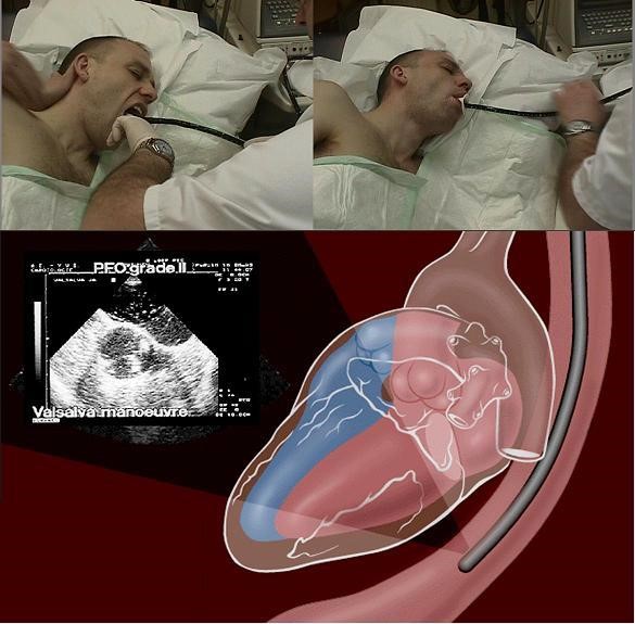 Что выбрать для сердца - ультразвук или электрокардиографию?