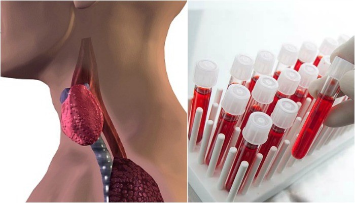 Почему назначают анализ крови на половые гормоны?