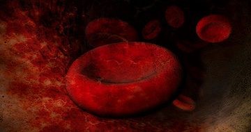 Как снизить билирубин в крови в домашних условиях