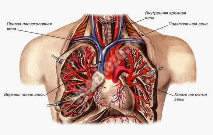 Катетеризация вен и артерий