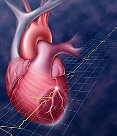 Коронография, как ведущий способ исследования сосудов сердца