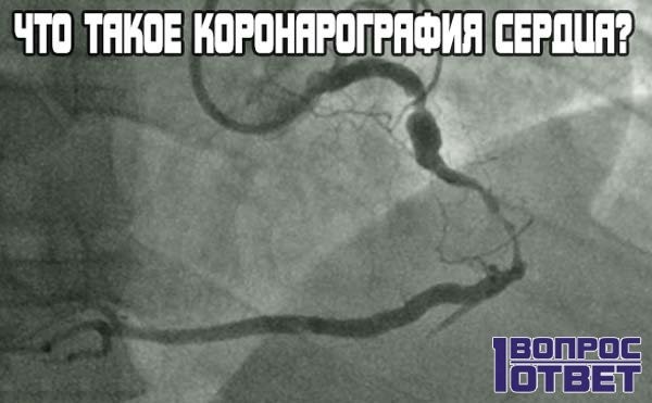 Как и для чего проводится коронарография сердца?