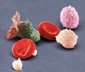 Что такое незрелые гранулоциты в анализе крови