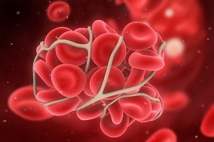 Что такое свертываемость крови и как ее определить