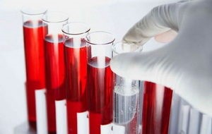 Анализ крови на АСТ и что значит, если этот показатель повышен
