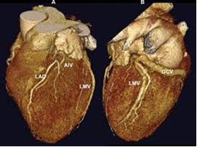Причины и показания к операции по замене сердечного клапана