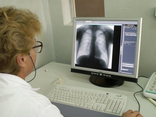 Необходимость проведения флюорографии при пневмонии