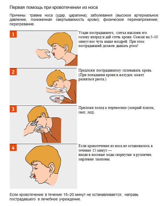 Как остановить кровь из носа