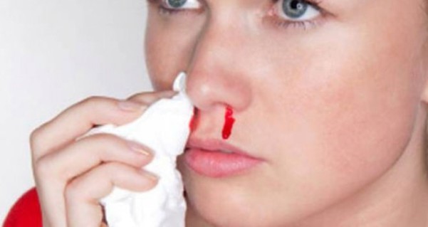 Как остановить кровь из носа