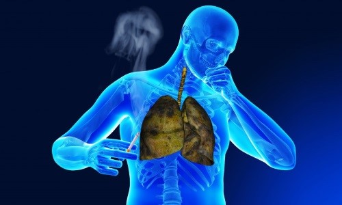 Как лечить кашель курильщика с мокротой