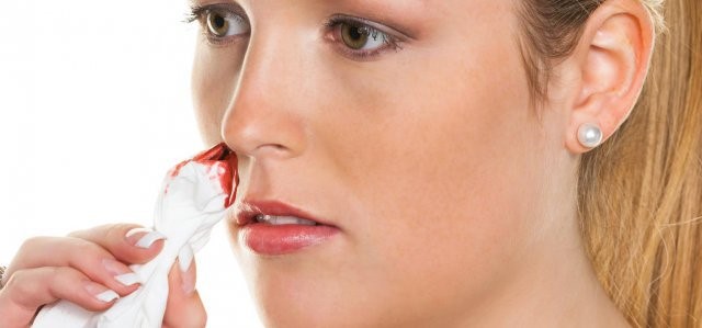Кровь из носа: причины у детей, взрослых, как остановить