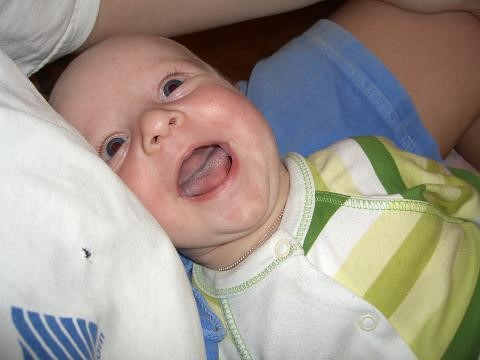 Молочница во рту, кандидоз: симптомы, лечение у детей