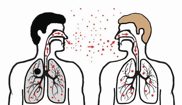 Опасность открытой формы туберкулеза