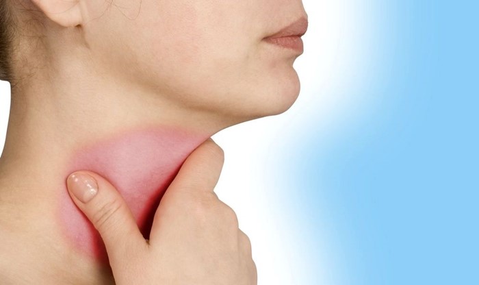 Ожог горла (гортани, слизистой глотки): лечение, симптомы
