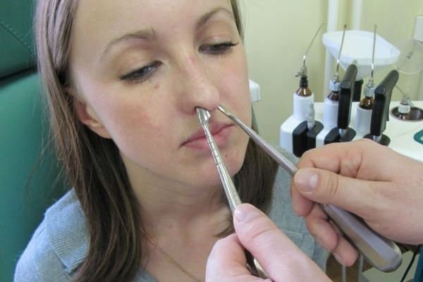 Методика проведения репозиции костей носа