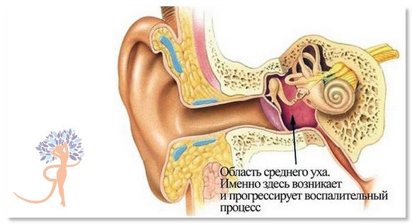 Инструкция по применению ушных капель Полидекса