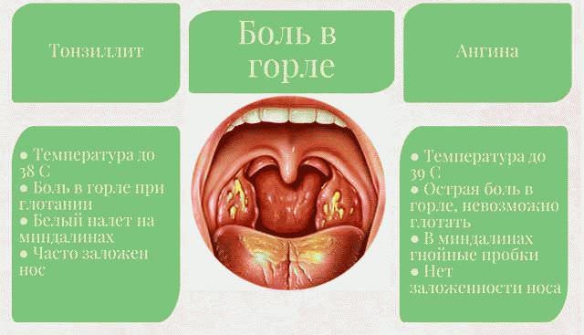 Заложенное горло