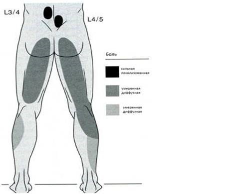 Емкий обзор артроза дугоотросчатых суставов