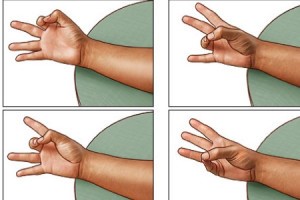 Как распознать и лечить артроз пальцев рук