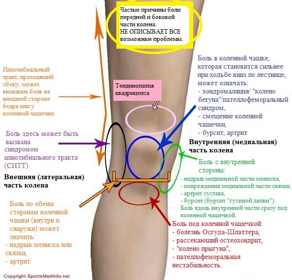 Боль в колене при разгибании ноги: почему больно разгибать сустав