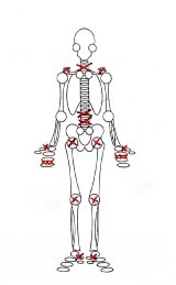 Что такое деформирующий остеоартроз коленного сустава: диагноз ДОА 1 и 2 степени