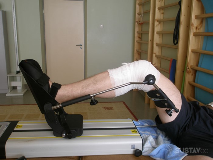 Эндопротезирование коленного сустава реабилитация после операции