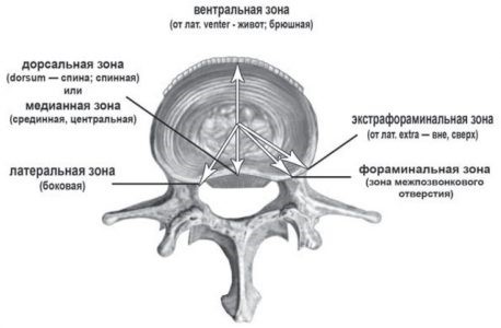 Межпозвоночная фораминальная грыжа диска