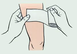 Повязка на колено: эластичная повязка на коленный сустав