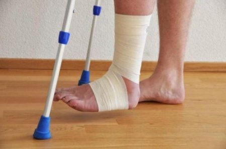 Как снять отек после перелома ноги?