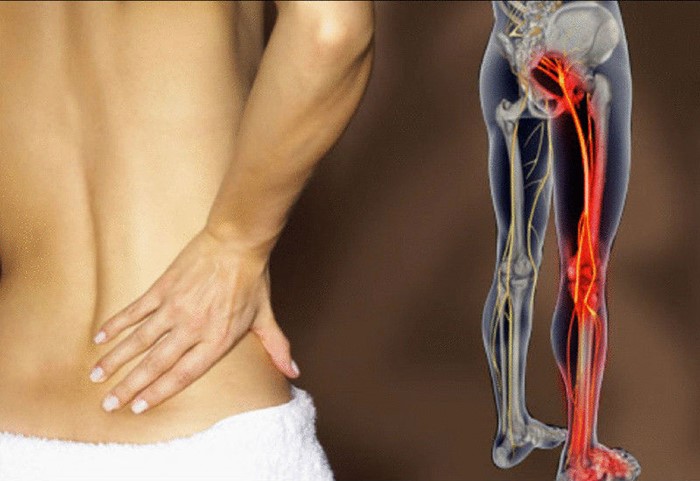 Почему возникает боль в колене сбоку: основные причины