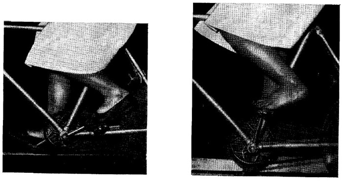 Разработка голеностопа после перелома: упражнения для ноги