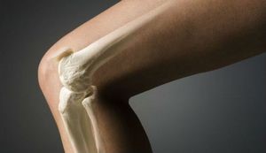 Посттравматический артрит: симптомы и лечение травматического артрита коленного сустава
